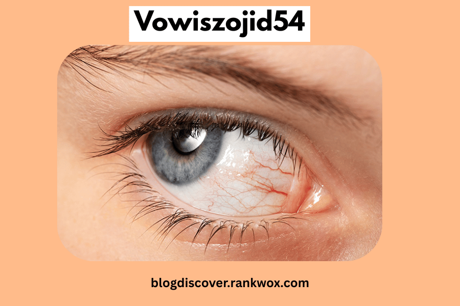 Is Vowiszojid54 for Sensitive Eyes? Benefits, Safety Tips, Ingredients & Best Alternatives 1 Vowiszojid54 for sensitive